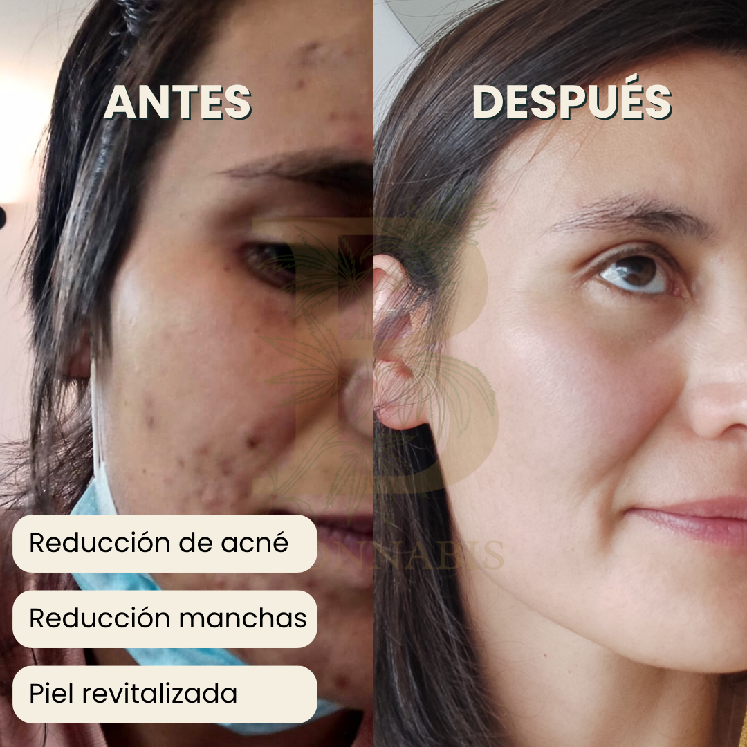 Ritual Piel Sana | Jabón + Serum + Ebook Glow Skin