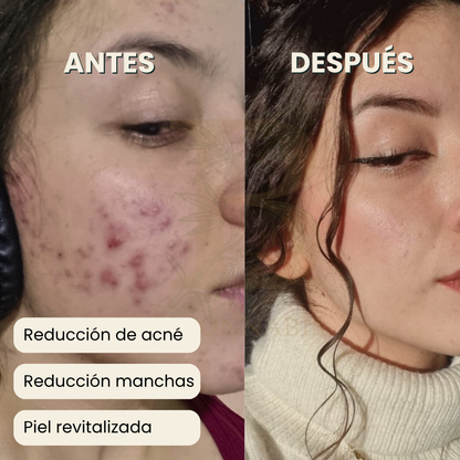 Ritual Piel Sana | Jabón + Serum + Ebook Glow Skin