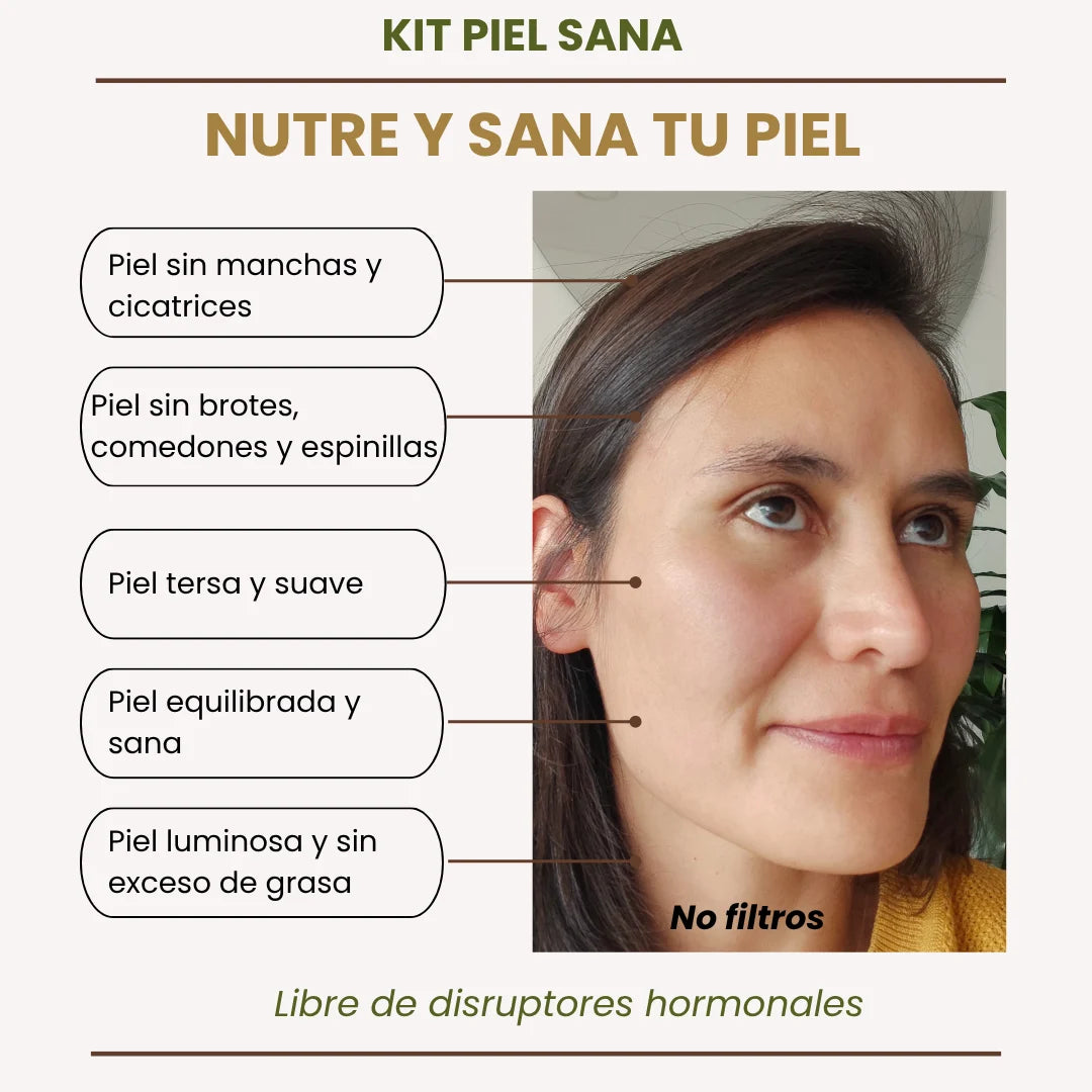 kit elimina el acné, piel sin manchas, sin brotes, sin exceso de grasa