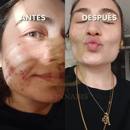Jabón Limpiador Facial
